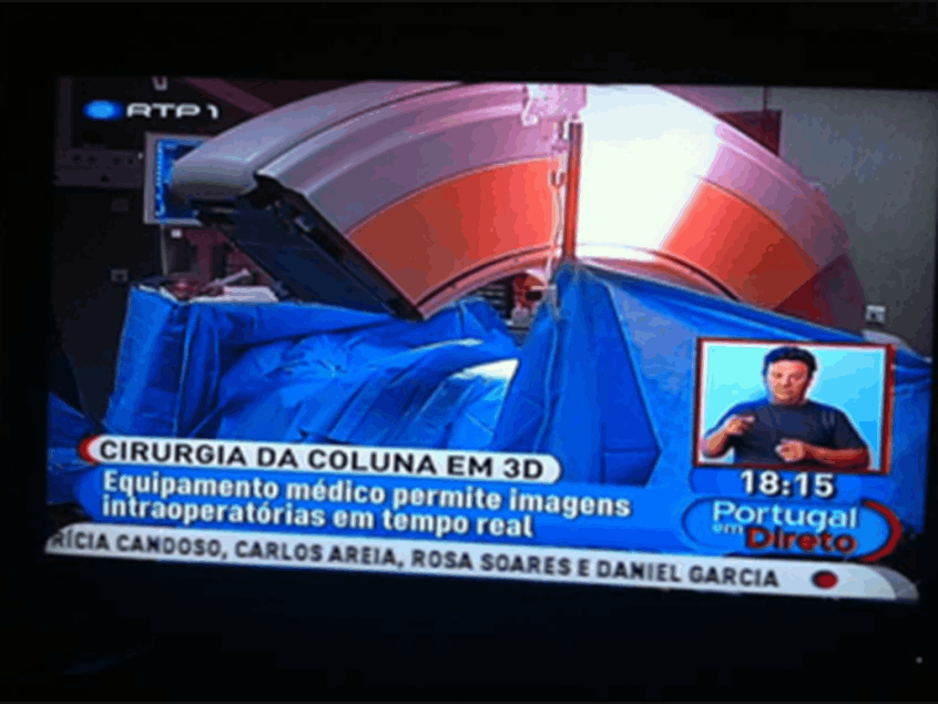 Reportagem televisiva sobre neuronavegação na Cirurgia da Coluna.